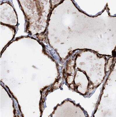 Immunohistochemistry-Paraffin: AFAP1L2 Antibody [NBP1-84859] - Staining of human thyroid gland shows strong cytoplasmic positivity in glandular cells.