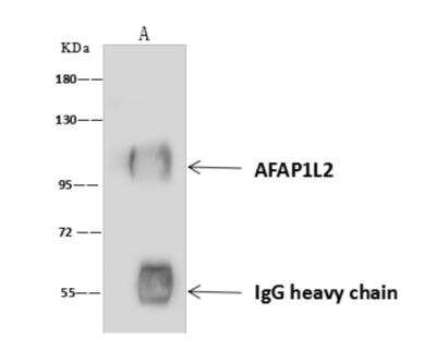 Immunoprecipitation: AFAP1L2 Antibody [NBP3-06316] - AFAP1L2 was immunoprecipitated using:Lane A: 0.5 mg U-251 MG Whole Cell Lysate4 uL anti-AFAP1L2 rabbit polyclonal antibody and 60 ug of Immunomagnetic beads Protein AG. Primary antibody:Anti-AFAP1L2 rabbit polyclonal antibody,at 1:100 dilution Secondary antibody:Goat Anti-Rabbit IgG (H+L)HRP   at 110000 dilutionDeveloped using the ECL technique.Performed under reducing conditions.Predicted band size: 91 kDaObserved band size :100 kDa