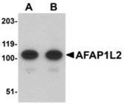 Western Blot: AFAP1L2 Antibody [NBP1-77358] - Mouse liver tissue lysate with AFAP1L2 antibody at (A) 1 and (B) 2 ug/ml.