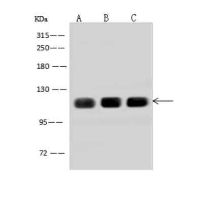 Western Blot: AFAP1L2 Antibody [NBP3-06316] - Anti-AFAP1L2 rabbit polyclonal antibody at 1:500 dilutionLane A: ACHN Whole Cell LysateLane B: HepG2 Whole Cell LysateLane C: U-251 MG Whole Cell LysateLysates/proteins at 30 ug per lane.SecondaryGoat Anti-Rabbit IgG (H+L) HRP at 110000 dilution.Developed using the ECL technique.Performed under reducing conditions.Predicted band size: 91 kDa