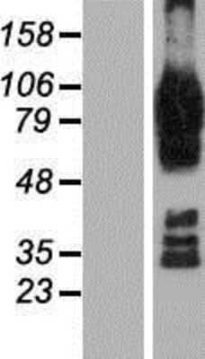 Western Blot: AFAP1L2 Overexpression Lysate (Adult Normal) [NBP2-09935] Left-Empty vector transfected control cell lysate (HEK293 cell lysate); Right -Over-expression Lysate for AFAP1L2.