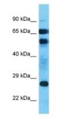 Western Blot: AFDN-DT Antibody [NBP3-09222] - Western blot analysis of AFDN-DT in Uterus Tumor lysates. Antibody dilution at 1.0ug/ml