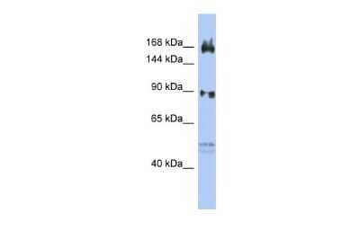 Western Blot: AFF2 Antibody [NBP2-84403] - WB Suggested Anti-AFF2 Antibody Titration: 0.2-1 ug/ml. ELISA Titer: 1:62500. Positive Control: OVCAR-3 cell lysateAFF2 is strongly supported by BioGPS gene expression data to be expressed in Human OVCAR3 cells