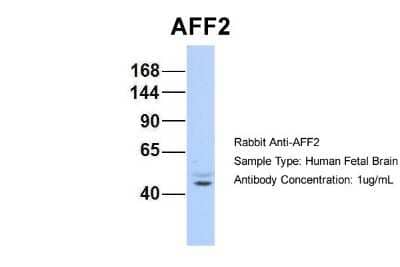 Western Blot: AFF2 Antibody [NBP2-84403] - Host: Rabbit. Target Name: AFF2. Sample Type: Human Fetal Brain. Antibody Dilution: 1.0ug/ml