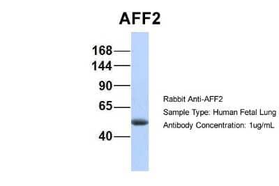 Western Blot: AFF2 Antibody [NBP2-84403] - Host: Rabbit. Target Name: AFF2. Sample Type: Human Fetal Lung. Antibody Dilution: 1.0ug/ml