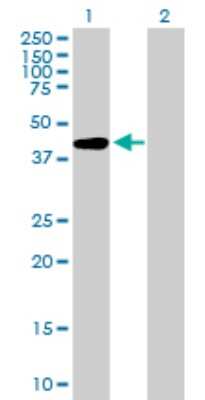 Western Blot: AFF4 Antibody [H00027125-B01P] - Analysis of AFF4 expression in transfected 293T cell line by AFF4 polyclonal antibody.  Lane 1: AFF4 transfected lysate(40.15 KDa). Lane 2: Non-transfected lysate.