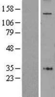 Western Blot: AFF4 Overexpression Lysate (Adult Normal) [NBL1-07373] Left-Empty vector transfected control cell lysate (HEK293 cell lysate); Right -Over-expression Lysate for AFF4.