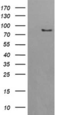 Western Blot: AFG3L2 Antibody (4B6) [NBP2-45476] - Analysis of HEK293T cells were transfected with the pCMV6-ENTRY control (Left lane) or pCMV6-ENTRY AFG3L2 .