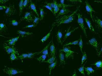 Immunocytochemistry/Immunofluorescence: AFG3L2 Antibody [NBP2-97748] - Immunofluorescence staining of AFG3L2 in U251MG cells. Cells were fixed with 4% PFA, permeabilzed with 0.1% Triton X-100 in PBS, blocked with 10% serum, and incubated with rabbit anti-Human AFG3L2 polyclonal antibody (dilution ratio 1:200) at 4C overnight. Then cells were stained with the Alexa Fluor(R)488-conjugated Goat Anti-rabbit IgG secondary antibody (green) and counterstained with DAPI (blue).Positive staining was localized to Cytoplasm.
