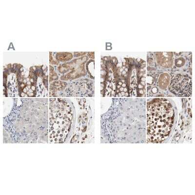 <b>Independent Antibodies Validation. </b>Immunohistochemistry-Paraffin: AFG3L2 Antibody [NBP1-87085] - Staining of human colon, kidney, liver and testis using Anti-AFG3L2 antibody NBP1-87085 (A) shows similar protein distribution across tissues to independent antibody NBP1-87086 (B).