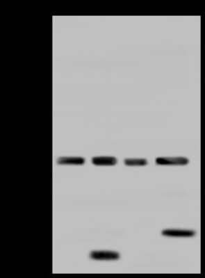 Western Blot: AFG3L2 Antibody [NBP2-97748] - Anti-AFG3L2 rabbit polyclonal antibody at 1:500 dilution. Lane A: Hela Whole Cell Lysate Lane B: MDA-MB453 Whole Cell Lysate Lane C: MCF-7 Whole Cell Lysate Lane D: Jurkat Whole Cell Lysate Lysates/proteins at 30 ug per lane. Secondary Goat Anti-Rabbit IgG (H+L)/HRP at 1/10000 dilution. Developed using the ECL technique. Performed under reducing conditions. Predicted band size: 89 kDa. Observed band size: 95 kDa (We are unsure as to the identity of these extra bands).