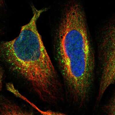 Immunocytochemistry/ Immunofluorescence AFTPH Antibody