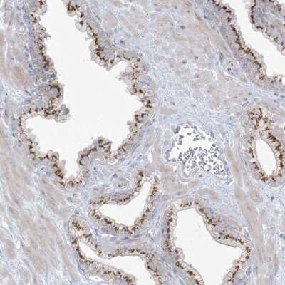 Immunohistochemistry-Paraffin: AFTPH Antibody [NBP2-38227] - Staining of human prostate shows strong cytoplasmic positivity in glandular cells.