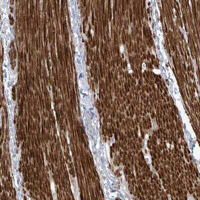 Immunohistochemistry-Paraffin AFTPH Antibody