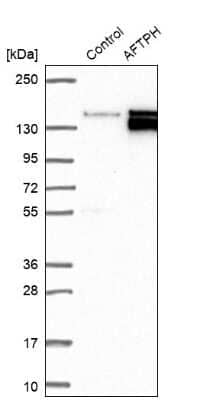 Western Blot AFTPH Antibody