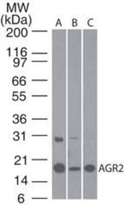 Western Blot: AG-2/AGR2 Antibody - Azide Free [NBP2-27392] - Analysis of AGR2 using AGR2 antibody. MCF7 (A), Caco-2 (B) and human stomach lysate (C) probed with AGR2 antibody at 1:100. were used for this test. The higher molecular weight band of variable intensity at ~30 kDa is uncharacterized and may represent a form of AGR2.