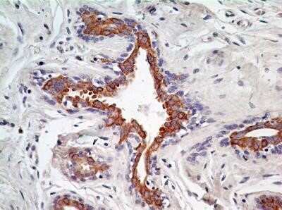 Immunohistochemistry-Paraffin: AG-2/AGR2 Antibody (10E2) - Azide and BSA Free [NBP2-80564] - Formalin-fixed, paraffin-embedded human breast stained with AGR2 antibody at 5 ug/ml. Staining of formalin-fixed tissues is enhanced by boiling tissue sections in 10 mM sodium citrate buffer, pH 6.0 for 10-20 min followed by cooling at RT for 20 min. Imag