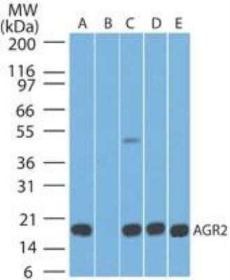 Western Blot: AG-2/AGR2 Antibody (10E2) - Azide and BSA Free [NBP2-80564] - Analysis of human stomach in the A) absense and B) presence of immunizing peptide, C) mouse stomach, D) rat stomach tissue lysate, and E) HCT-116 cell lysate using AGR2 antibody at 5 ug/ml. Goat anti-mouse Ig HRP secondary antibody and PicoTect ECL substrate solution were used for this test. Image from the standard format of this antibody.