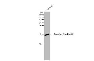 Western Blot: AG-2/AGR2 Antibody (HL1024) [NBP3-13684] - Rat tissue extract (50 ug) was separated by 15% SDS-PAGE, and the membrane was blotted with AG-2/AGR2 antibody [HL1024] (NBP3-13684) diluted at 1:1000. The HRP-conjugated anti-rabbit IgG antibody (NBP2-19301) was used to detect the primary antibody.