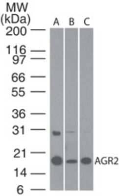 Western Blot: AG-2/AGR2 Antibody [NBP2-27393] - Analysis using the Azide Free version of NBP2-27393. Detection of AGR2 using AGR2 antibody. MCF7 (A), Caco-2 (B) and human stomach lysate (C) probed with AGR2 antibody at 1:100. were used for this test. The higher molecular weight band of variable intensity at ~30 kDa is uncharacterized and may represent a form of AGR2.