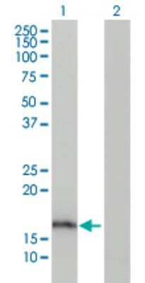 Western Blot: AG-2 Antibody (1C3) [H00010551-M03] - Analysis of AGR2 expression in transfected 293T cell line by AGR2 monoclonal antibody (M03), clone 1C3. Lane 1: AGR2 transfected lysatE (20 KDa). Lane 2: Non-transfected lysate.