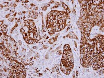 Immunohistochemistry-Paraffin: AG-3/AGR3 Antibody [NBP1-33008] -  Paraffin-embedded A549 xenograft, using antibody at 1:500 dilution.