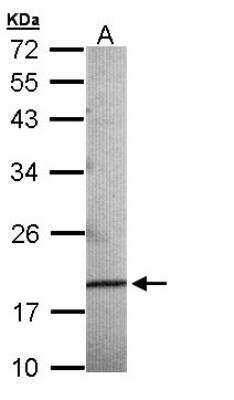 Western Blot: AG-3/AGR3 Antibody [NBP1-33008] - Sample (30 ug of whole cell lysate) A: 293T 12% SDS PAGE, antibody diluted at 1:500.