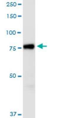 Western Blot: AGAP1 Antibody (3F2) [H00116987-M01-100ug] - analysis of AGAP1 expression in IMR-32.