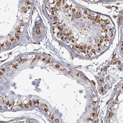 Immunohistochemistry: AGAP1 Antibody [NBP2-49005] - Staining of human testis shows strong cytoplasmic positivity in cells in seminiferus ducts.