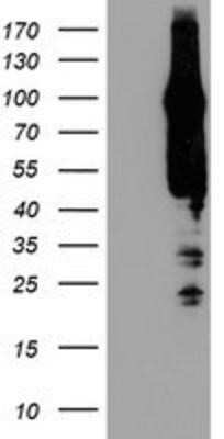 Flow Cytometry: AGAP1 Antibody (OTI4E8) - Azide and BSA Free [NBP2-72357] - HEK293T cells were transfected with the pCMV6-ENTRY control (Left lane) or pCMV6-ENTRY AGAP1 (Right lane) cDNA for 48 hrs and lysed. Equivalent amounts of cell lysates (5 ug per lane) were separated by SDS-PAGE and immunoblotted with anti-AGAP1.