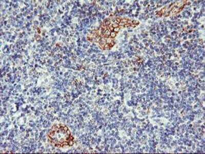 Immunohistochemistry: AGAP1 Antibody (OTI4E8) - Azide and BSA Free [NBP2-72357] - Staining of paraffin-embedded Human tonsil using anti-AGAP1 mouse monoclonal antibody.