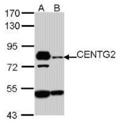 Western Blot AGAP1 Antibody