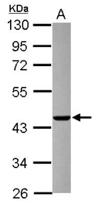 Western Blot AGAP1 Antibody