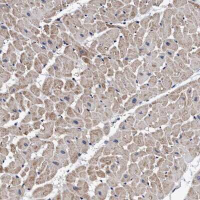 Immunohistochemistry-Paraffin: AGAP2 Antibody [NBP1-85686] - Staining of human heart muscle shows moderate cytoplasmic positivity in cardiomyocytes.