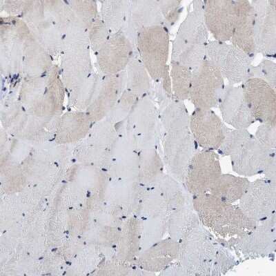 Immunohistochemistry-Paraffin: AGAP2 Antibody [NBP1-85686] - Staining of human skeletal muscle shows very weak cytoplasmic positivity in myocytes.