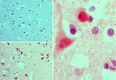 Immunohistochemistry-Paraffin: AGAP2 Antibody [NBP2-24498] - Analysis human brain tissue using an isotype control (top left) and this antibody (bottom left, right) at 5 ug/ml.