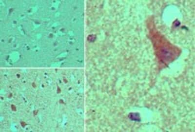 Immunohistochemistry-Paraffin: AGAP2 Antibody [NBP2-24554] - Analysis of AGAP2 in formalin-fixed, paraffin-embedded human brain tissue using an isotype control (top left) and this antibody (bottom left, right) at 5 ug/ml.