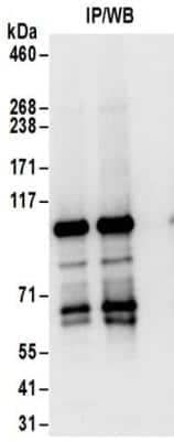 Immunoprecipitation: AGAP2 Antibody [NBP2-32176] - Samples:  Whole cell lysate (0.5 or 1.0 mg per IP reaction; 20% of IP loaded) from Jurkat cells. Antibodies:  Affinity purified rabbit anti-AGAP2 antibody NBP2-32176 used for IP at 6 ug per reaction. For blotting immunoprecipitated AGAP2 was used at 1 ug/ml.  Detection: Chemiluminescence with an exposure time of 10 seconds.