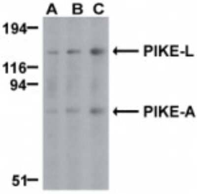 Western Blot: AGAP2 Antibody [NBP1-77194] - Analysis of AGAP2 in mouse brain cell lysates with anti-AGAP2 (CT) using this antibody at (A) 0.5, (B) 1, and (C) 2 ug/ml.