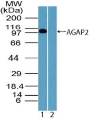 Western Blot: AGAP2 Antibody [NBP2-24498] - Analysis of AGAP2 in Jurkat cell lysate in the 1) absence and 2) presence of immunizing peptide using this antibody. I goat anti-rabbit Ig HRP secondary antibody and PicoTect ECL substrate solution were used for this test.