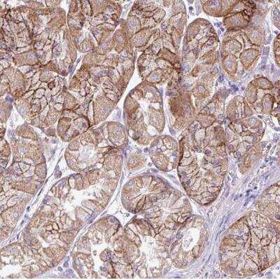 Immunohistochemistry-Paraffin AGAP4 Antibody - BSA Free