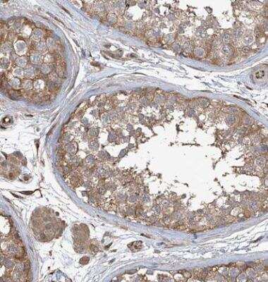 Immunohistochemistry-Paraffin AGBL5 Antibody