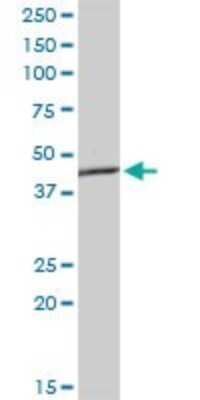 Western Blot: AGER Antibody (1C1) [H00000177-M02] - AGER monoclonal antibody (M02), clone 1C1. Analysis of AGER expression in human kidney.