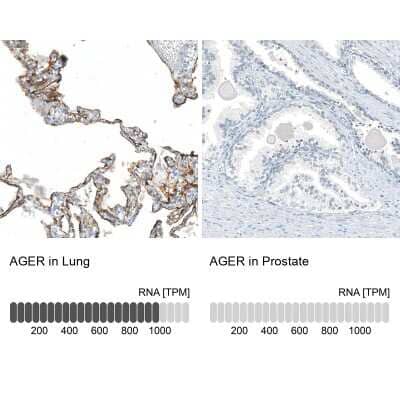 Immunohistochemistry-Paraffin: AGER Antibody (CL10587) [NBP3-07982] - Analysis in human lung and prostate tissues using NBP3-07982 antibody. Corresponding AGER RNA-seq data are presented for the same tissues.