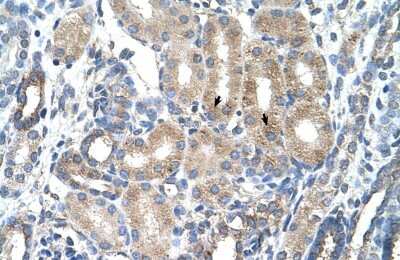 Immunohistochemistry-Paraffin: AGER Antibody [NBP1-59048] - Human kidney Tissue, antibody concentration 4-8ug/ml. Cells with positive label: renal corpuscle cells (indicated with arrows) 400X magnification.