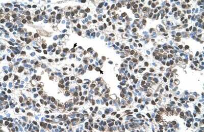 Immunohistochemistry-Paraffin: AGER Antibody [NBP1-59049] - Human Lung Alveolar cells (indicated with arrows), 4-8ug/ml.