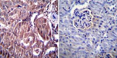 Immunohistochemistry-Paraffin: AGER Antibody [NBP3-13484] - IHC-P analysis of normal mouse kidney tissue with (ledt) or without (right) AGER antibody at a dilution of 1:20. Heat induced antigen retrieval was performed using 10mM sodium citrate (pH6.0) buffer, microwaved for 8-15 minutes. Antigen Retrieval: Trilogy(TM) (EDTA based, pH 8.0) buffer, 15min