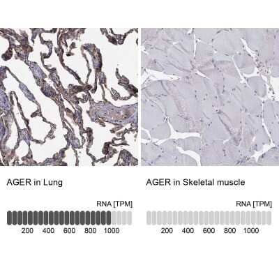 Immunohistochemistry-Paraffin: AGER Antibody [NBP3-16981] - Analysis in human lung and skeletal muscle tissues using Anti-AGER antibody. Corresponding AGER RNA-seq data are presented for the same tissues.