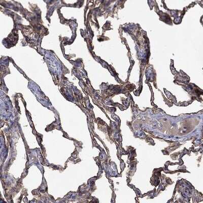 Immunohistochemistry-Paraffin: AGER Antibody [NBP3-16981] - Staining of human lung shows high expression.