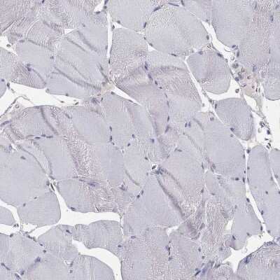 Immunohistochemistry-Paraffin: AGER Antibody [NBP3-16981] - Staining of human skeletal muscle shows low expression as expected.